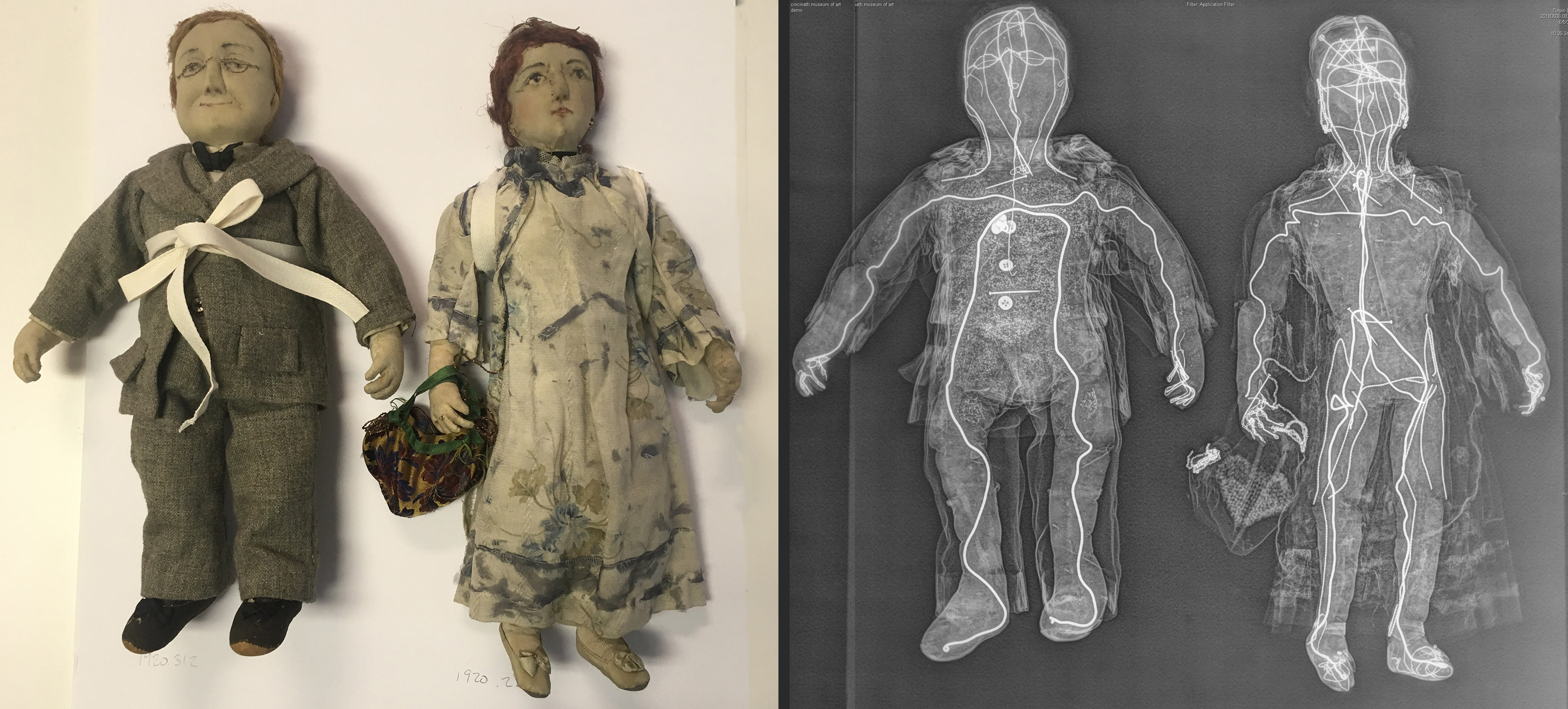 two dolls and their x-rays