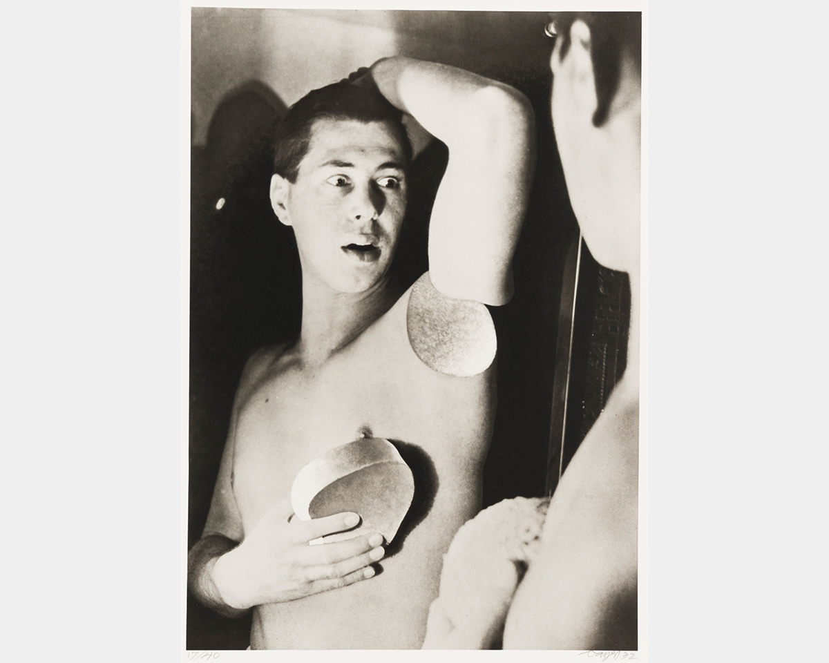 Black and white photo of a man with a surprised expression whose arm seems to have detached at his shoulder